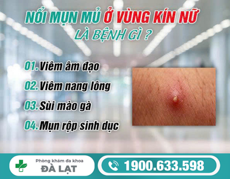 Hình ảnh minh họa